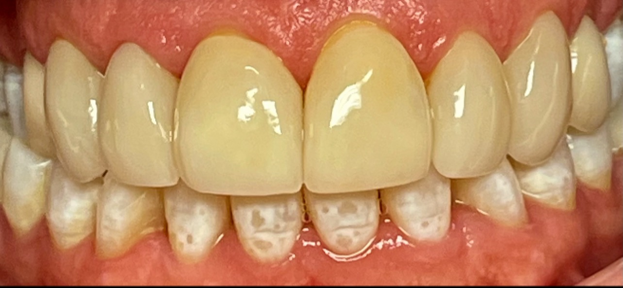 Paradise Valley Family Dental | Dental Cleanings, TMJ Disorders and Digital Impressions